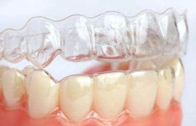 Aparelho dental Invisalign em Monsenhor Paulo